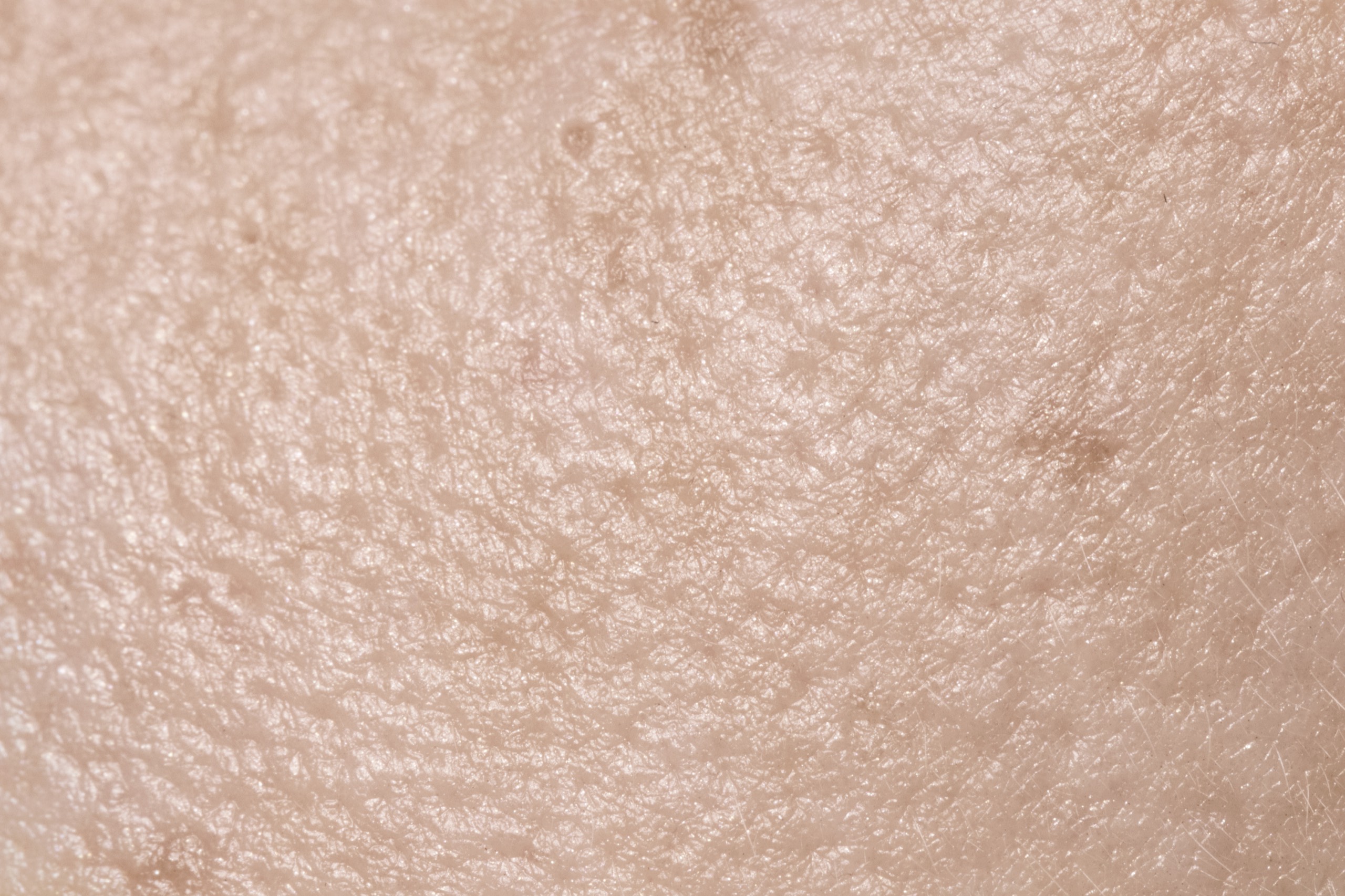Pale skin in macro close up, its fine lines and pores filling the frame